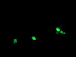 POLR3C Monoclonal Antibody (OTI2H1), TrueMAB , OriGene 100 &mu;L; Unconjugated:Antibodies,