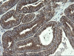 POLR3C Monoclonal Antibody (OTI2H1), TrueMAB , OriGene 100 &mu;L; Unconjugated:Antibodies,