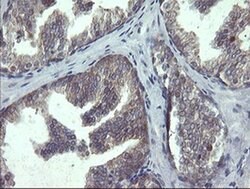POLR3C Monoclonal Antibody (OTI2H1), TrueMAB , OriGene 100 &mu;L; Unconjugated:Antibodies,