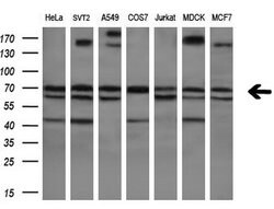 POLR3C Monoclonal Antibody (OTI2H1), TrueMAB , OriGene 100 &mu;L; Unconjugated:Antibodies,