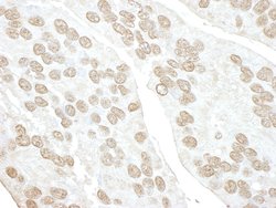 POLR3D Polyclonal Antibody, Bethyl Laboratories:Antibodies:Primary Antibodies
