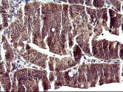 POLR3GL Mouse anti-Human, Clone: OTI2F11, lyophilized, TrueMAB 100 &mu;g;