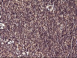 POLR3GL Mouse anti-Human, Clone: OTI2F11, lyophilized, TrueMAB 100 &mu;g;