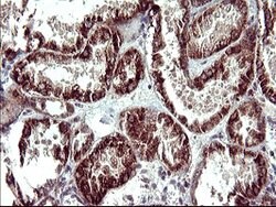 POLR3GL Mouse anti-Human, Clone: OTI2F11, lyophilized, TrueMAB 100 &mu;g;