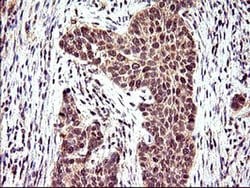 POLR3GL Monoclonal Antibody (OTI5F9), TrueMAB , OriGene 100 &mu;L; Unconjugated:Antibodies,