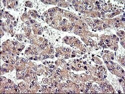 POLR3GL Monoclonal Antibody (OTI5F9), TrueMAB , OriGene 100 &mu;L; Unconjugated:Antibodies,