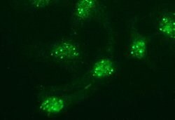 POMC Monoclonal Antibody (OTI1A8), TrueMAB , OriGene:Antibodies:Primary