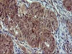 POMC Monoclonal Antibody (OTI2B2), TrueMAB , OriGene:Antibodies:Primary