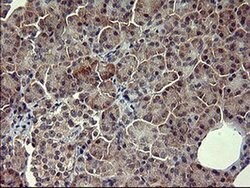 POMC Monoclonal Antibody (OTI1F3), TrueMAB , OriGene:Antibodies:Primary