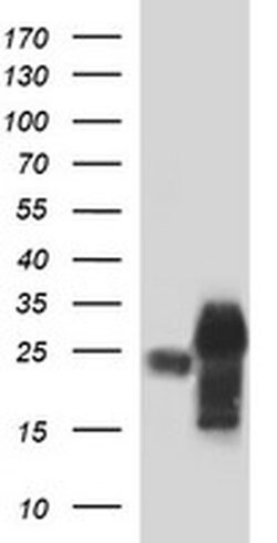 POMC Monoclonal Antibody (OTI2B2), TrueMAB , OriGene:Antibodies:Primary