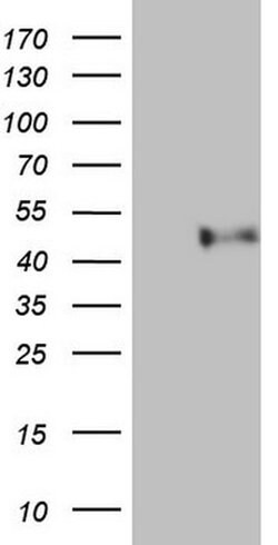PON3 Monoclonal Antibody (OTI5B5), TrueMAB , OriGene 100 &mu;L; Unconjugated:Antibodies,