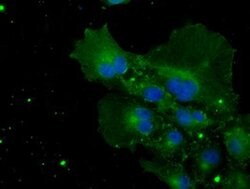 POR Mouse anti-Human, Clone: OTI6C4, TrueMAB , Origene 30 &mu;L | Buy Online | Origene Technologies | Fisher Scientific