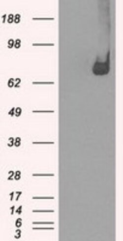 POR Mouse anti-Human, Clone: OTI4G2, lyophilized, TrueMAB 100 &mu;g; Unconjugated:Antibodies,