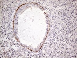 POTEG Monoclonal Antibody (OTI2G1), TrueMAB , OriGene 30 &mu;L; Unconjugated:Antibodies,