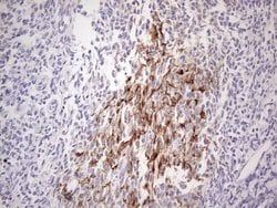 POTEG Mouse anti-Human, Clone: OTI2G1, lyophilized, TrueMAB 100 &mu;g;