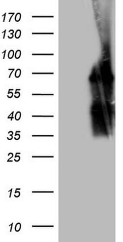 POTEG Monoclonal Antibody (OTI10A6), TrueMAB , OriGene 100 &mu;L; Unconjugated:Antibodies,