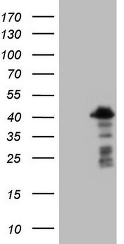 POU2AF1 Monoclonal Antibody (OTI1E11), TrueMAB , OriGene 30 &mu;L; Unconjugated:Antibodies,