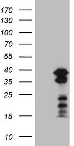 POU2AF1 Mouse anti-Human, Clone: OTI2D4, lyophilized, TrueMAB 100 &mu;g | Buy Online | OriGene | Fisher Scientific