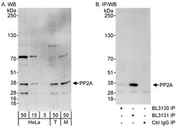 PP2A Rabbit anti-Human, Mouse, Polyclonal, Bethyl Laboratories 100 &mu;L;