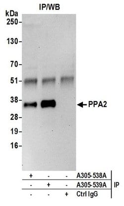 PPA2 Rabbit anti-Human, Polyclonal, Bethyl Laboratories 100 &mu;L; Unconjugated:Antibodies,