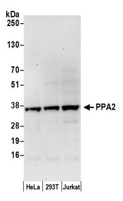 PPA2 Rabbit anti-Human, Polyclonal, Bethyl Laboratories 100 &mu;L; Unconjugated:Antibodies,