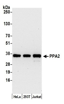 PPA2 Polyclonal Antibody, Bethyl Laboratories:Antibodies:Primary Antibodies