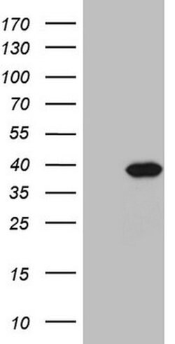 PPA2 Mouse anti-Human, Clone: OTI7C1, lyophilized, TrueMAB 100 &mu;g; Unconjugated:Antibodies,