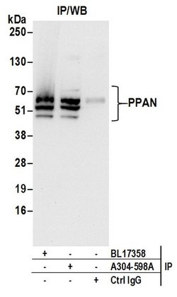 PPAN Rabbit anti-Human, Polyclonal, Bethyl Laboratories 100 &mu;L; Unconjugated:Antibodies,