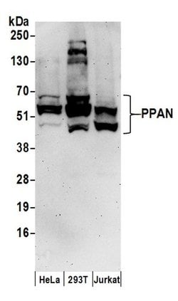 PPAN Rabbit anti-Human, Polyclonal, Bethyl Laboratories 100 &mu;L; Unconjugated:Antibodies,