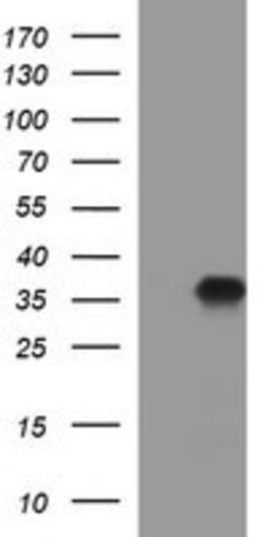 PPAP2A Mouse anti-Human, Clone: OTI1H4, lyophilized, TrueMAB 100 &mu;g;