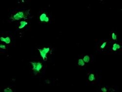 PPARA Monoclonal Antibody (OTI2E7), TrueMAB , OriGene:Anticuerpos:Anticuerpos