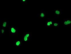 PPARA Monoclonal Antibody (OTI2G6), TrueMAB , OriGene 100 &mu;L; Unconjugated:Antibodies,