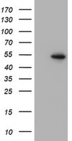 PPARA Monoclonal Antibody (OTI2D10), TrueMAB , OriGene 30 &mu;L; Unconjugated:Antibodies,