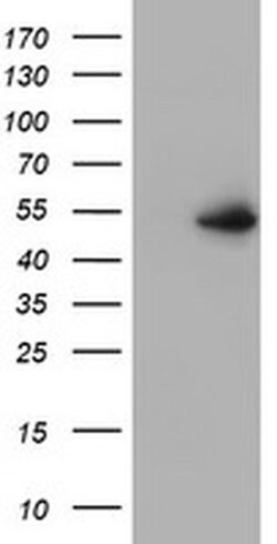 PPARA Monoclonal Antibody (OTI3G3), TrueMAB , OriGene 30 &mu;L; Unconjugated:Antibodies,