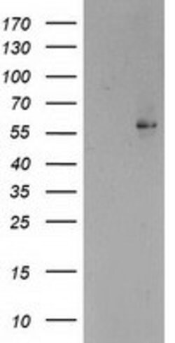 PPARA Mouse anti-Human, Mouse, Clone: OTI1E8, lyophilized, TrueMAB 100