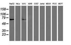 PPARA Mouse anti-Human, Mouse, Clone: OTI1E8, lyophilized, TrueMAB 100