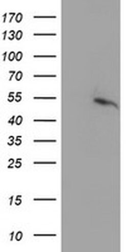 PPARA Monoclonal Antibody (OTI2E7), TrueMAB , OriGene 100 &mu;L | Buy Online | Origene Technologies | Fisher Scientific