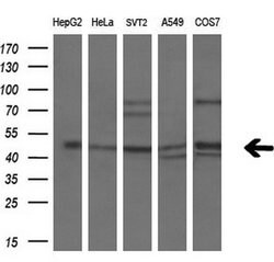 PPARA Monoclonal Antibody (OTI2E7), TrueMAB , OriGene 100 &mu;L | Buy Online | Origene Technologies | Fisher Scientific