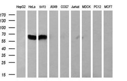 PPARA Monoclonal Antibody (OTI2G6), TrueMAB , OriGene 100 &mu;L; Unconjugated:Antibodies,