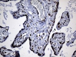 PPARD Mouse anti-Human, Clone: OTI4D10, lyophilized, TrueMAB 100 &mu;g;