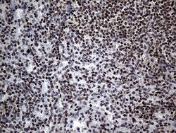 PPARD Mouse anti-Human, Clone: OTI4D10, lyophilized, TrueMAB 100 &mu;g;