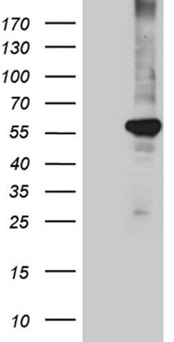 PPARD Mouse anti-Human, Clone: OTI4D10, lyophilized, TrueMAB 100 &mu;g;