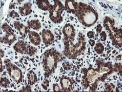 PPAT Monoclonal Antibody (OTI1B11), TrueMAB , OriGene 100 &mu;L; Unconjugated:Antibodies,