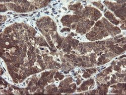 PPAT Monoclonal Antibody (OTI1B11), TrueMAB , OriGene:Antibodies:Primary