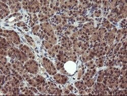 PPAT Monoclonal Antibody (OTI1B11), TrueMAB , OriGene 100 &mu;L; Unconjugated:Antibodies,