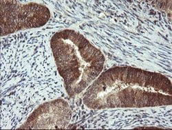 PPAT Monoclonal Antibody (OTI1B11), TrueMAB , OriGene 100 &mu;L; Unconjugated:Antibodies,