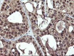 PPAT Monoclonal Antibody (OTI1B11), TrueMAB , OriGene:Antibodies:Primary