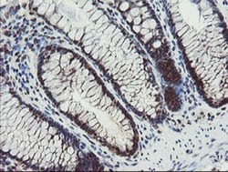 PPAT Monoclonal Antibody (OTI1B11), TrueMAB , OriGene 100 &mu;L; Unconjugated:Antibodies,