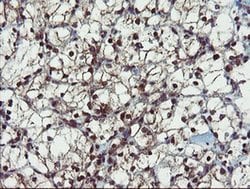 PPAT Monoclonal Antibody (OTI1B11), TrueMAB , OriGene 100 &mu;L; Unconjugated:Antibodies,
