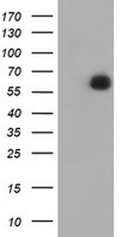 PPAT Monoclonal Antibody (OTI3C6), TrueMAB , OriGene:Antibodies:Primary